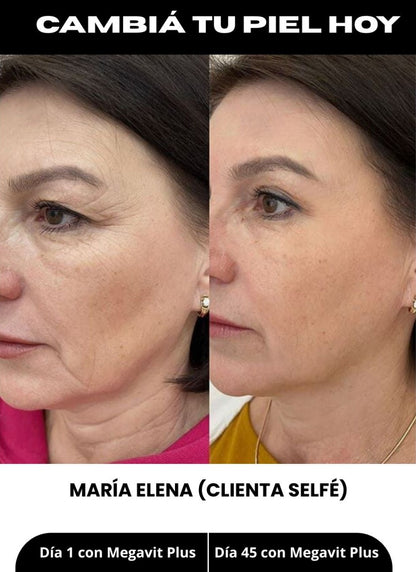 Megavit Plus Cosmética Premium: Tratamiento para Arrugas, Flacidez, Manchas y Reafirmante – 250 ML.