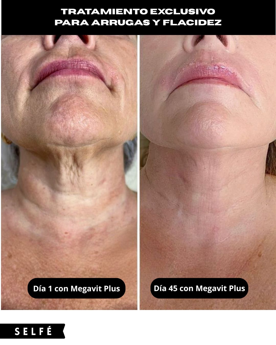 Megavit Plus Cosmética Premium: Tratamiento para Arrugas, Flacidez, Manchas y Reafirmante – 250 ML.